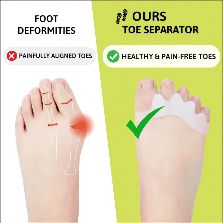 Beoros Care | Toe Separator